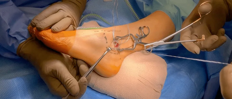 roboticknee