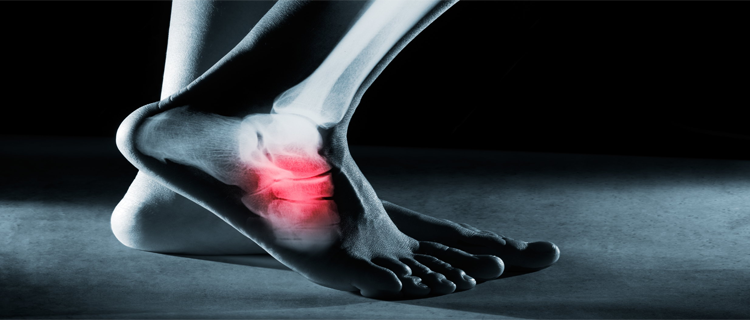 roboticknee