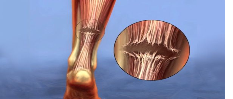 roboticknee