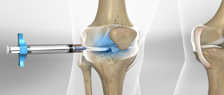 roboticknee
