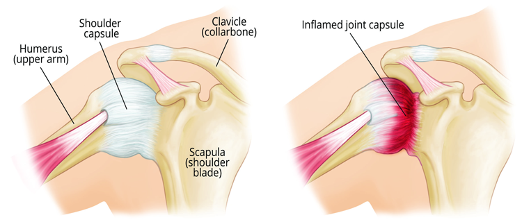roboticknee
